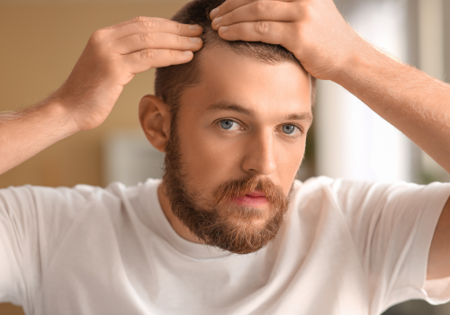 Anti Hair fall Treatment APRP Bio PRP