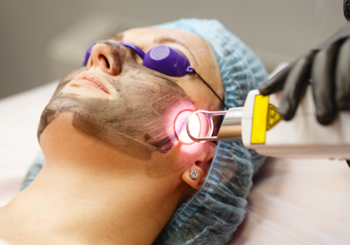 Pigmentation removal